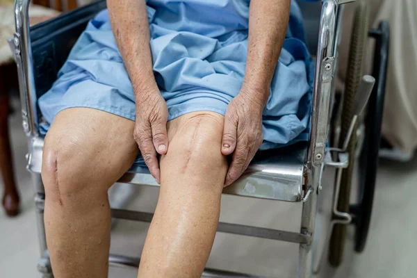 Traveling with Arthritis: Tips for Comfort and Convenience